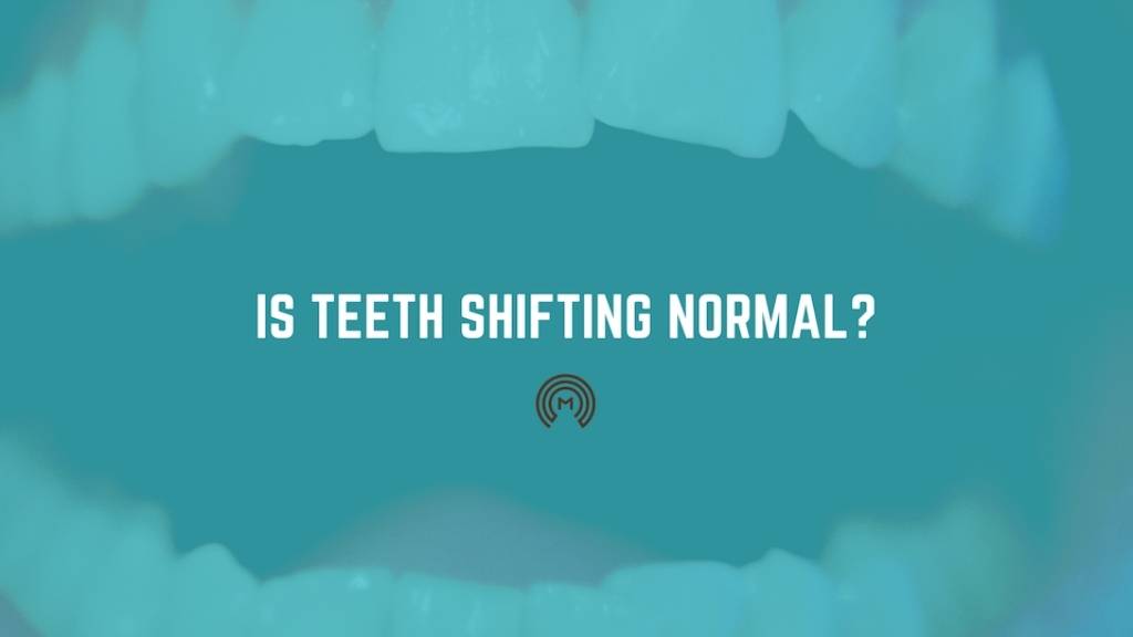 teeth shifting