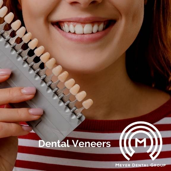dental veneers dentist mount prospect