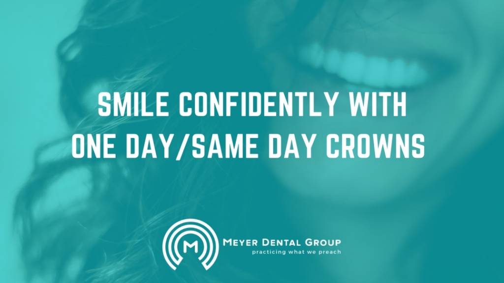 smile confidently with one day crowns