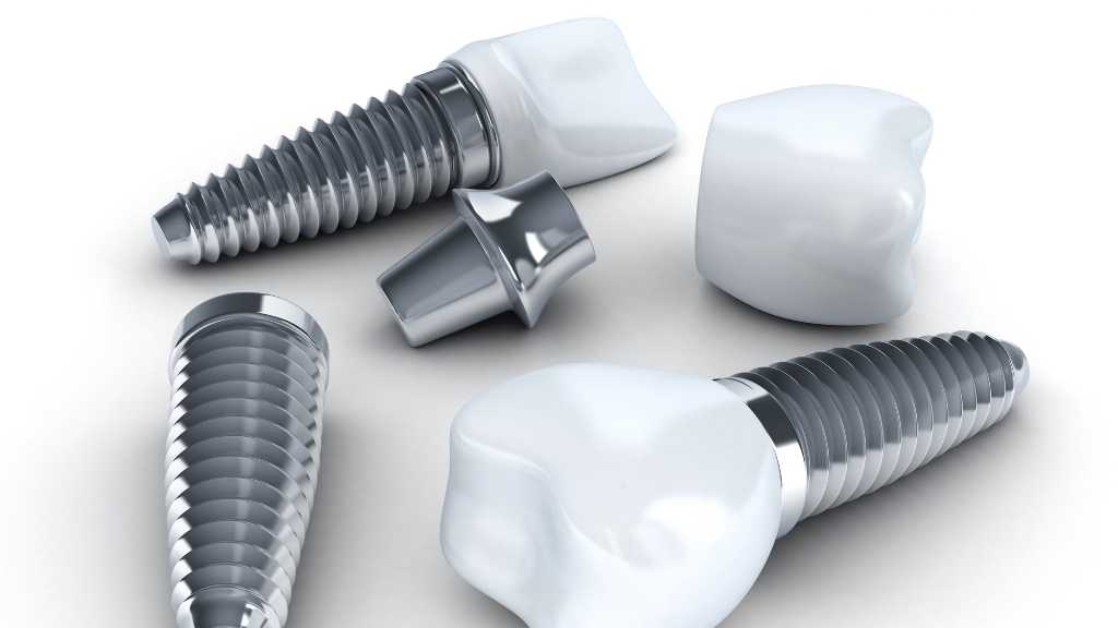 Dental implants mount prospect composition