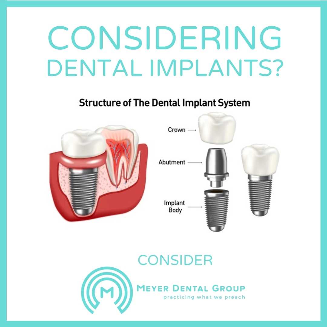 dental implants mt prospect