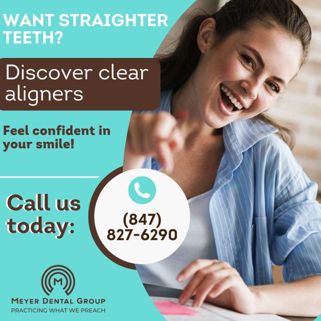 clear aligners