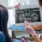 tmj-diagnosis-mt-prospect-dentist