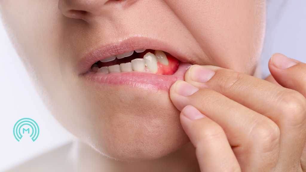 periodontal-gum-disease-dentistry-meyer-dental